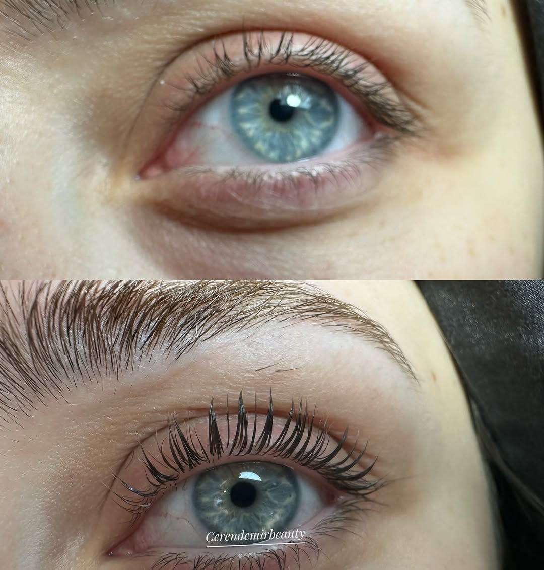 Ceren Demir Beauty Galeri Görseli - 15