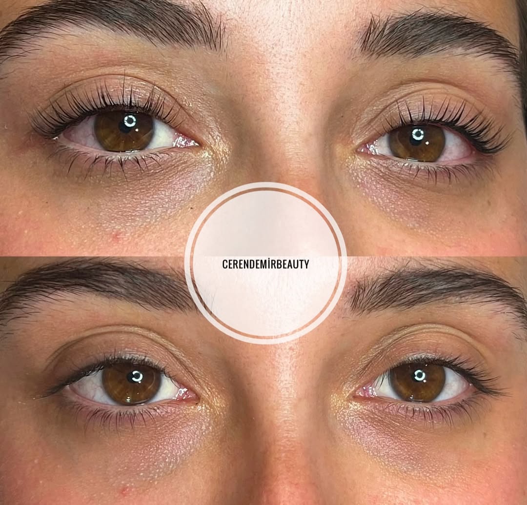 Ceren Demir Beauty Galeri Görseli - 5
